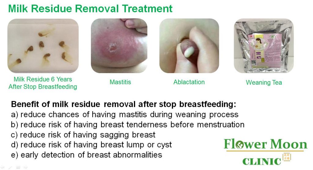 Milk Residue Removal Treatment >>> Click here to learn more